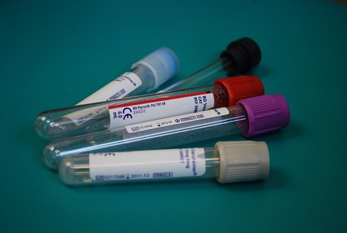 Laboratorní testy krve a moči na přítomnost thc