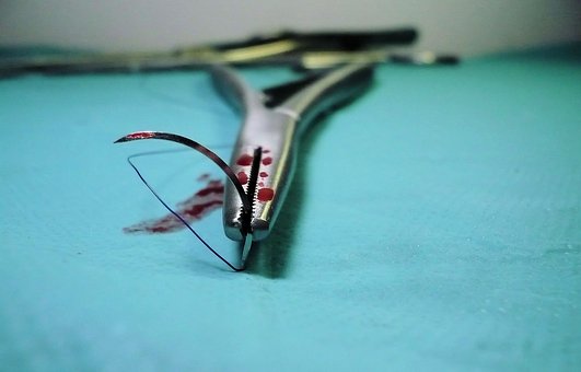 Test z fyziologie #8211; metodologie, anestézie a chirurgická technika