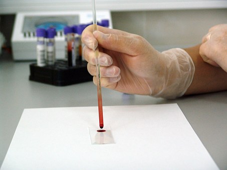 Krevní testy po kousnutí klíštěte, dají se zjistit drogy?