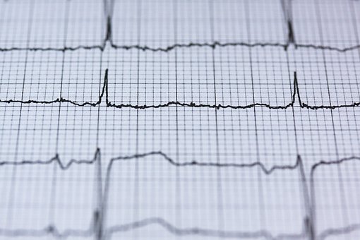 Extrasystoly a vrozená srdeční vada
